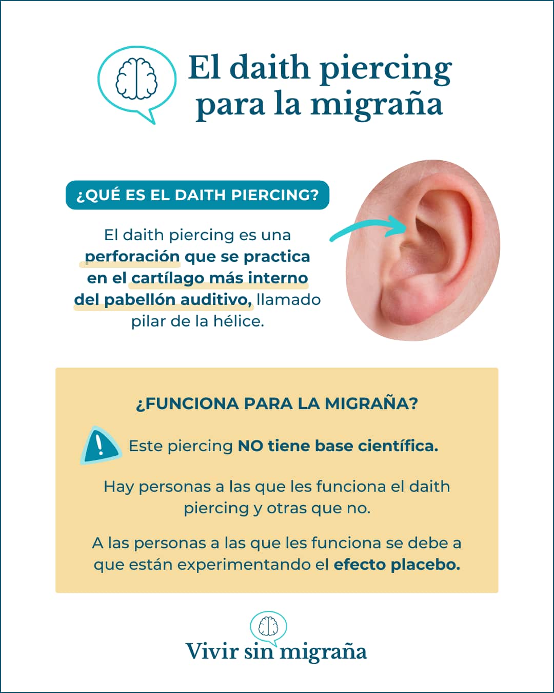 Piercing migraña